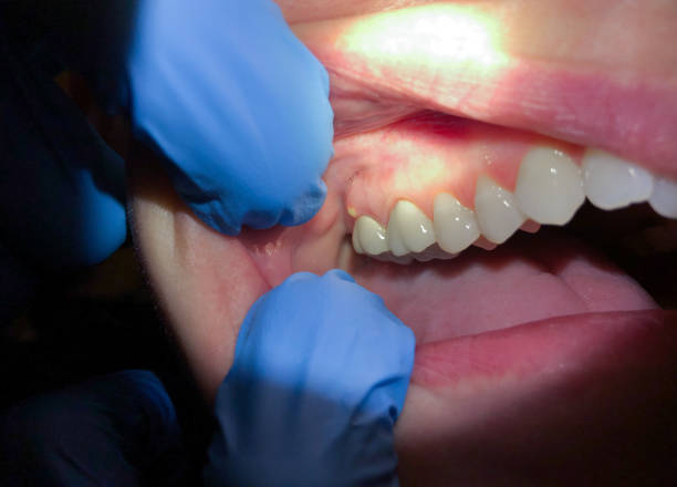 Best Emergency Dentist Near Me  in Ukiah, CA