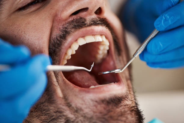 Best Emergency Gum Pain Relief  in Ukiah, CA